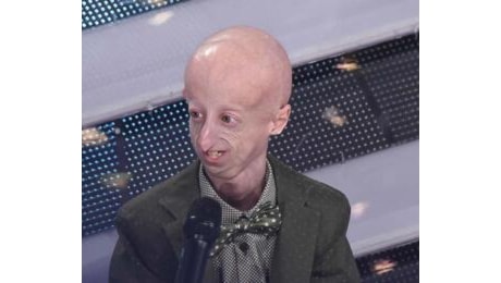 Morte Sammy Basso, Meloni rilancia sui social la lettera del biologo affetto da progeria