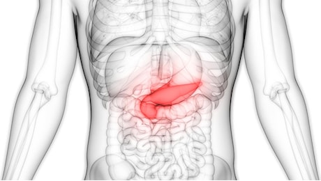 Tumore al pancreas, ancora molto difficile guarire ma si guadagna tempo per i pazienti. Otto casi su dieci scoperti tardi