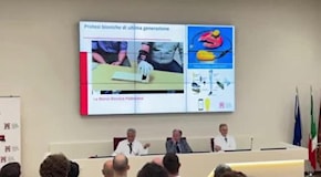 Padova, protesi bioniche per gli arti amputati: la dimostrazione video