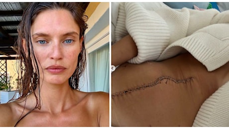 Bianca Balti, la cicatrice dopo l'intervento: «La foto più coraggiosa che abbia mai visto sui social»