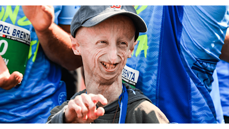 Addio a Sammy Basso, aveva 28 anni. Aveva fatto conoscere la Progeria