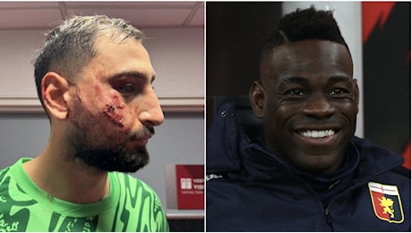 Donnarumma deriso dai compagni dopo il terribile infortunio in faccia: Balotelli è impietoso